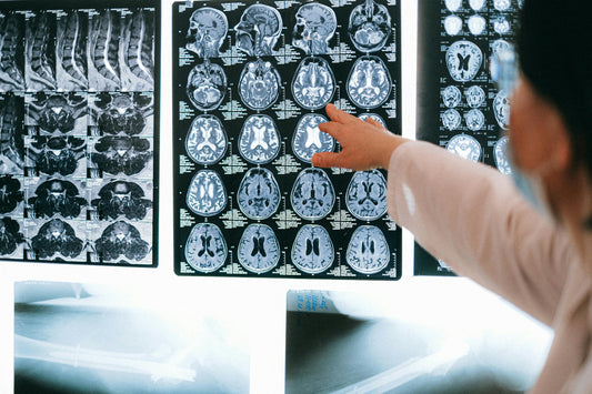 The link between lifestyle and brain health explained