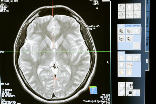 How Stress Affects the Brain and What Can Help