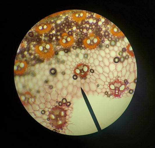 Ever Wondered How Cancer Cells “Decide” to Spread?