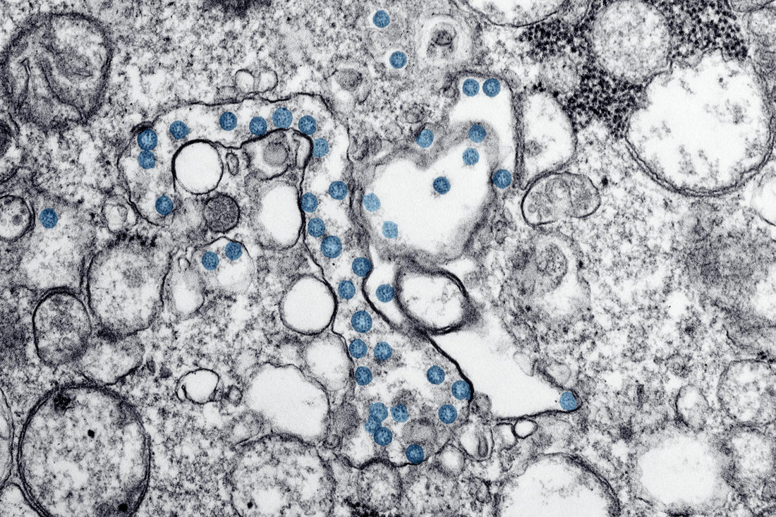 Obesity and Severe Infections