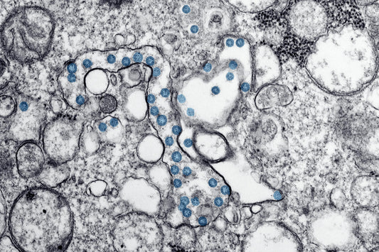 Obesity and Severe Infections