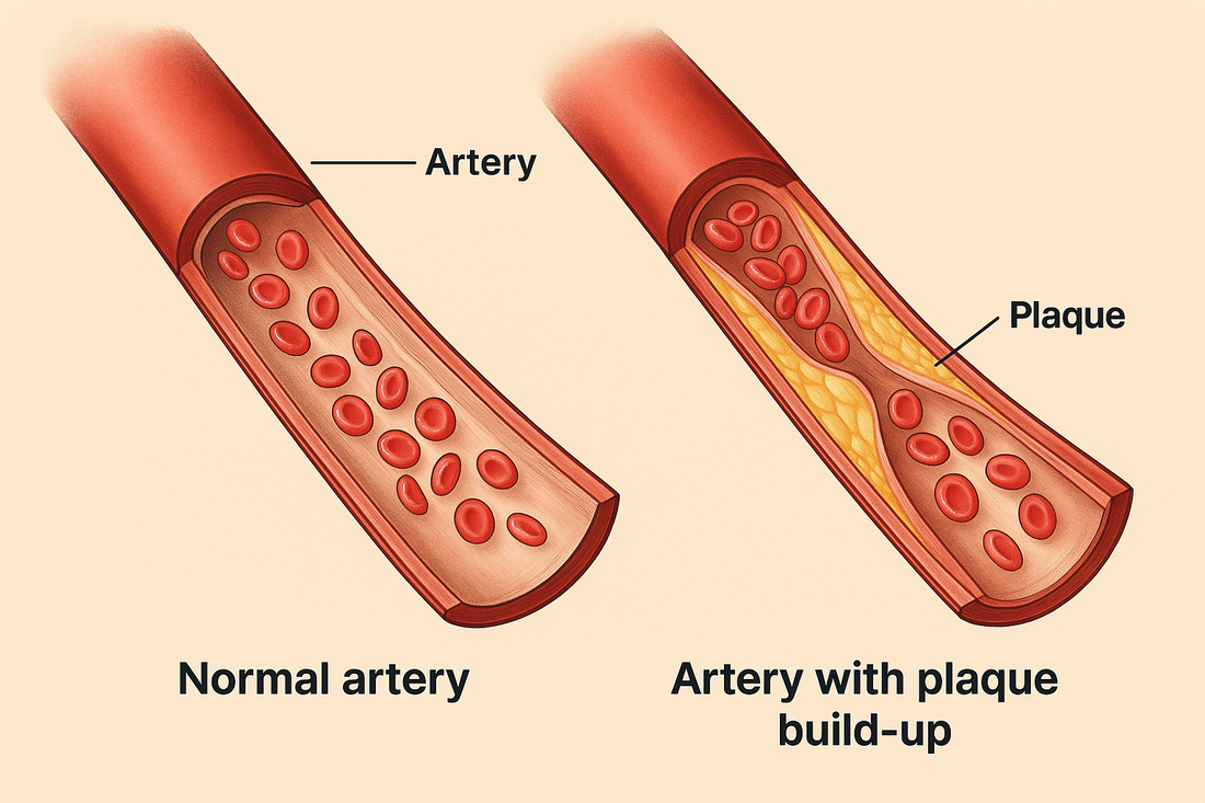 New Treatment Helps Lower Bad Cholesterol More Effectively