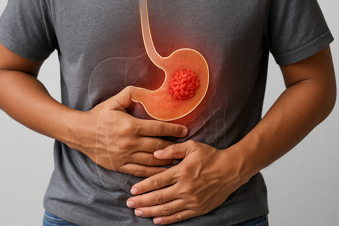How Your Daily Diet Can Increase Stomach Cancer Risk
