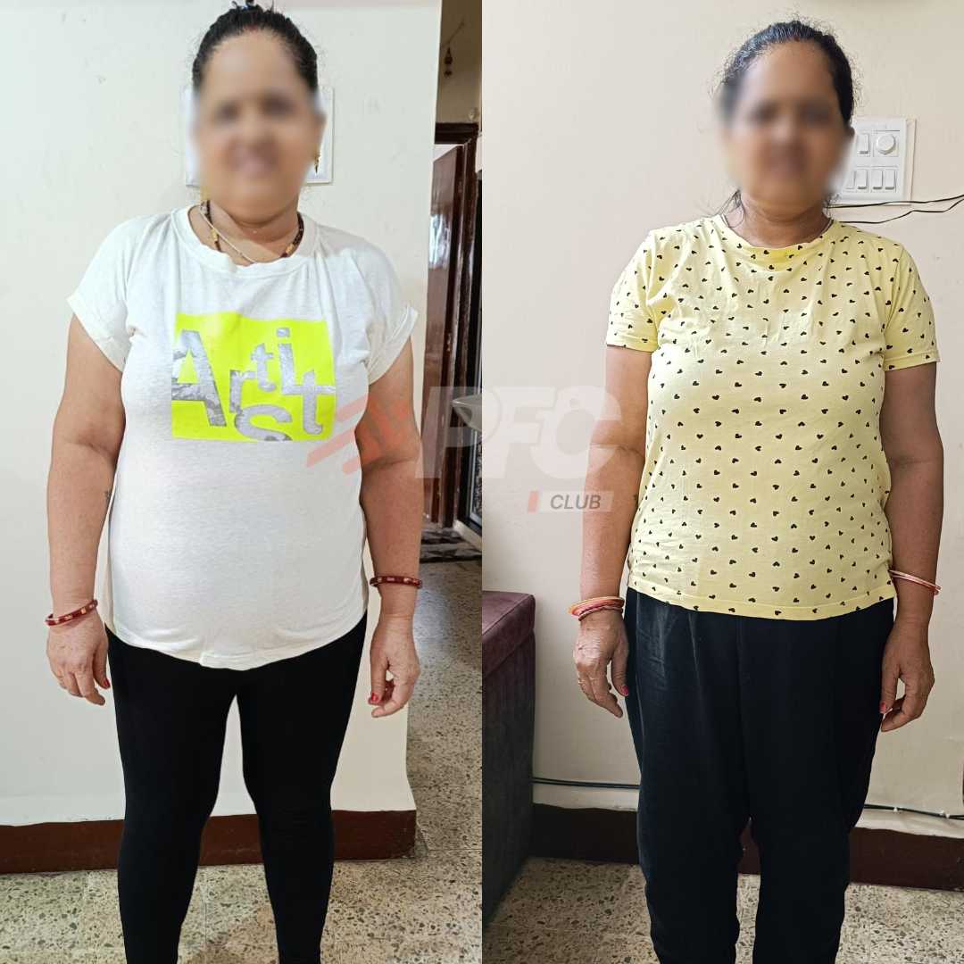 Transformation Image