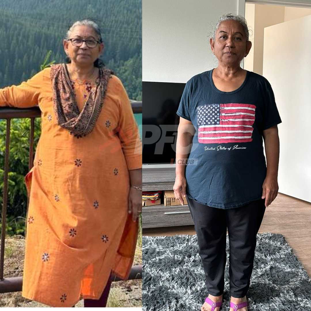 Transformation Image