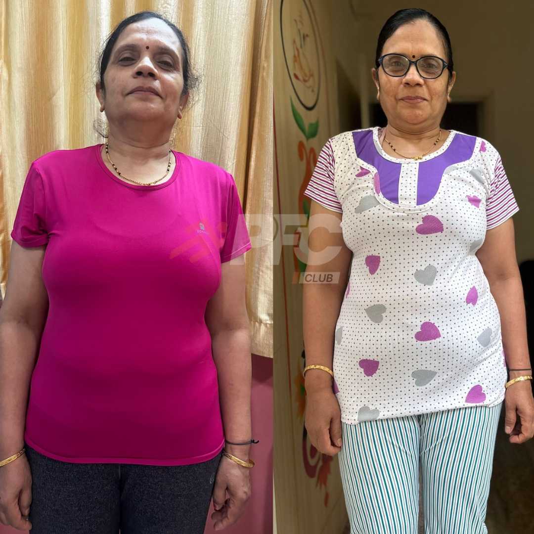 Transformation Image