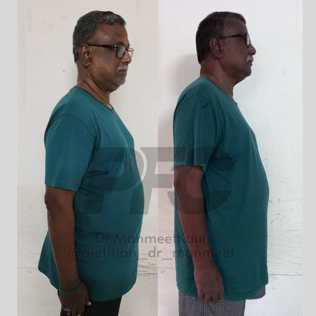 Transformation Image