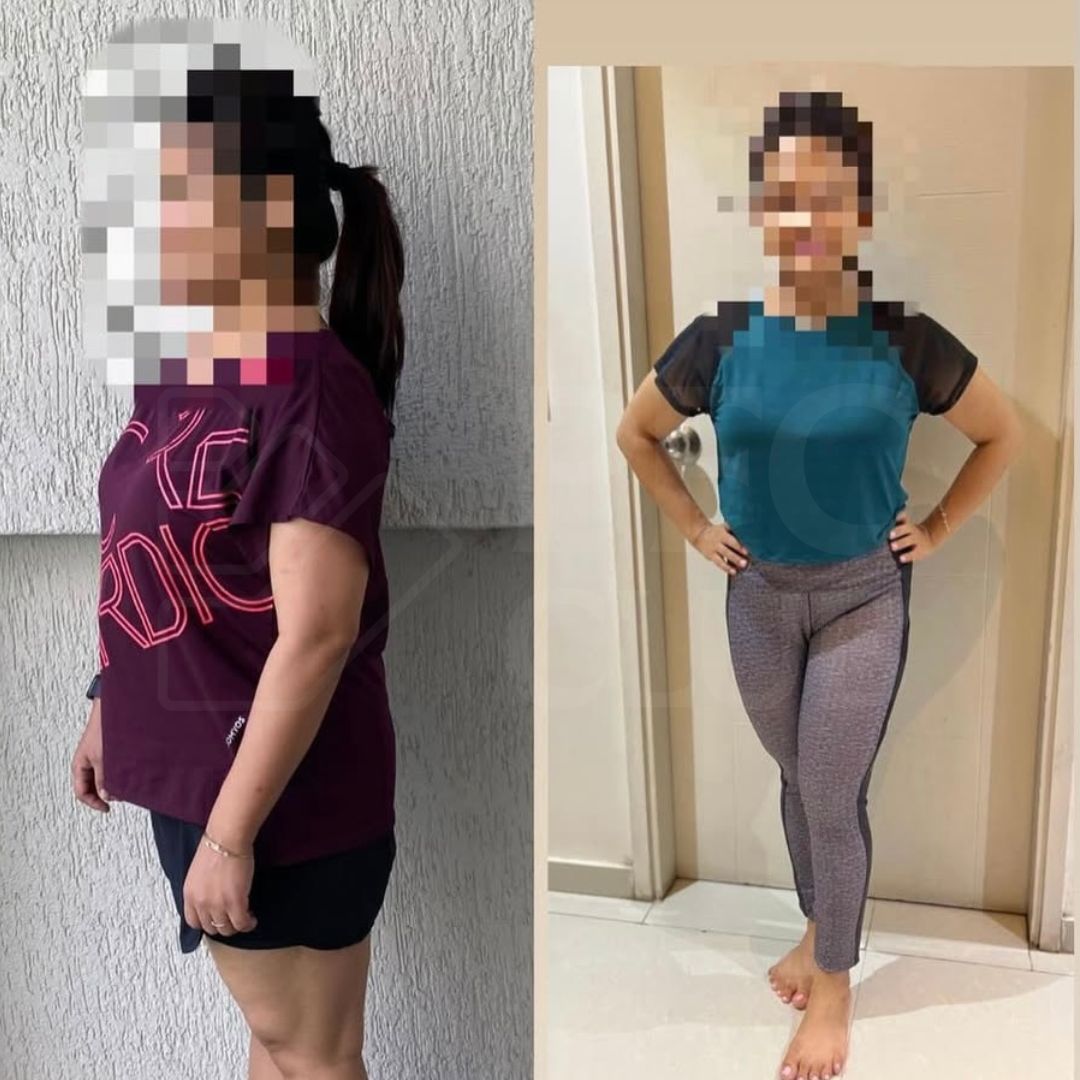 Transformation Image