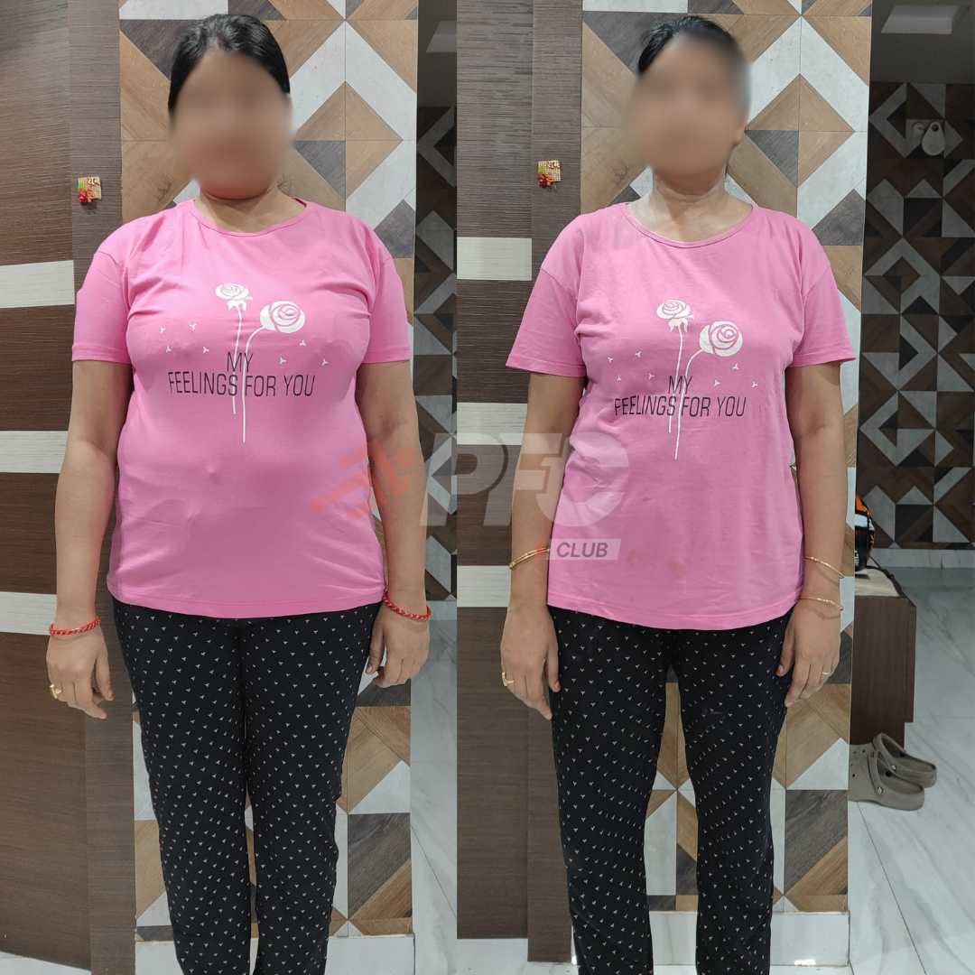 Transformation Image