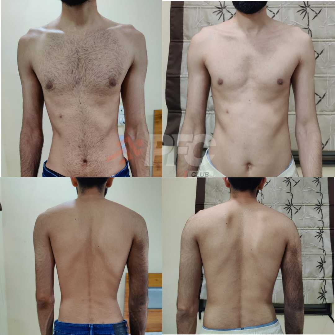 Transformation Image