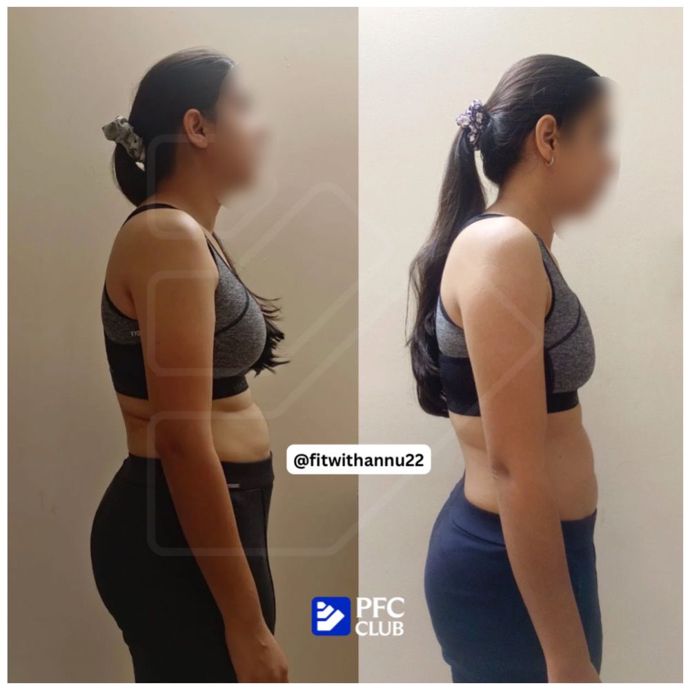 Transformation Image