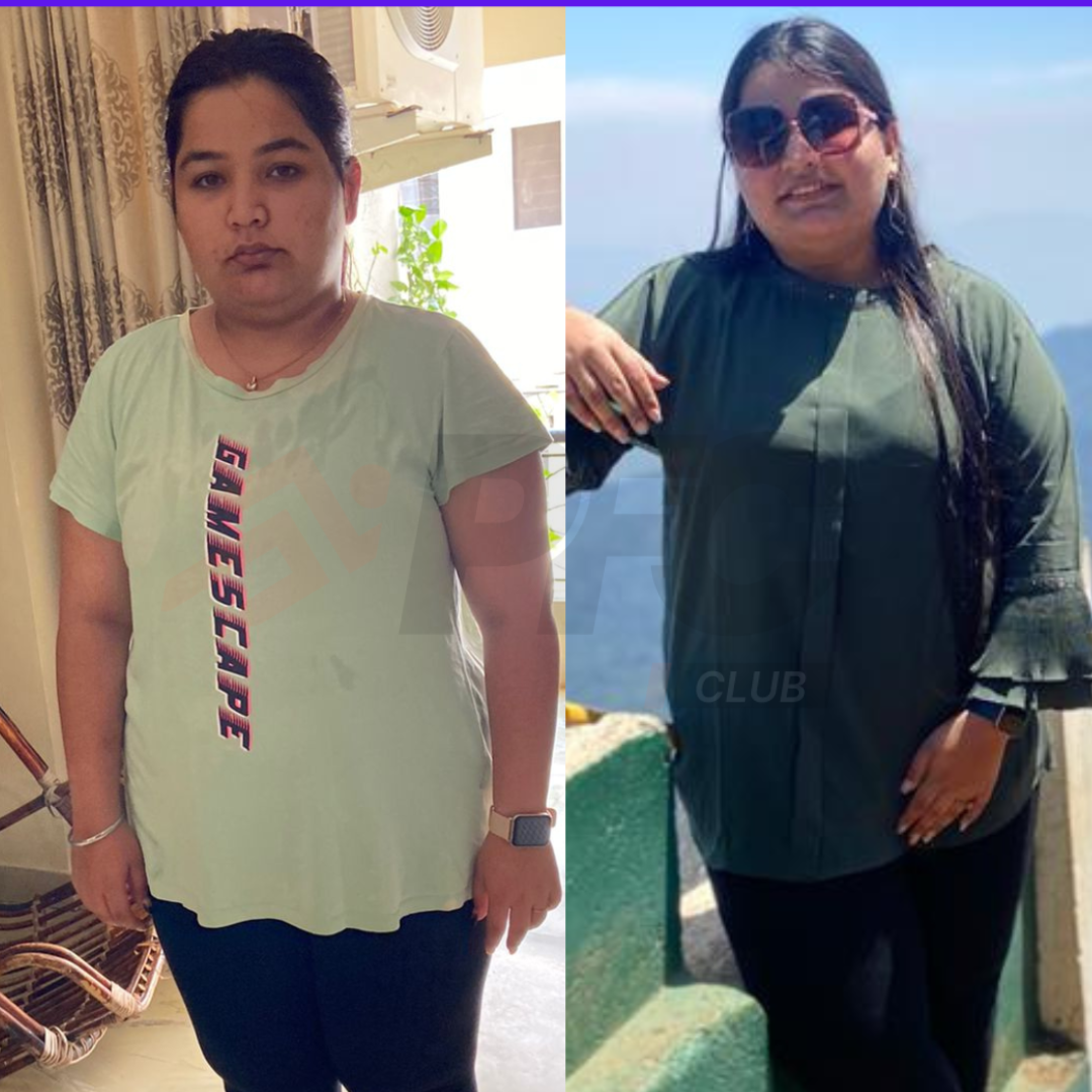 Transformation Image