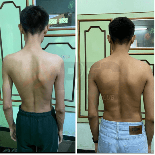 Transformation Image