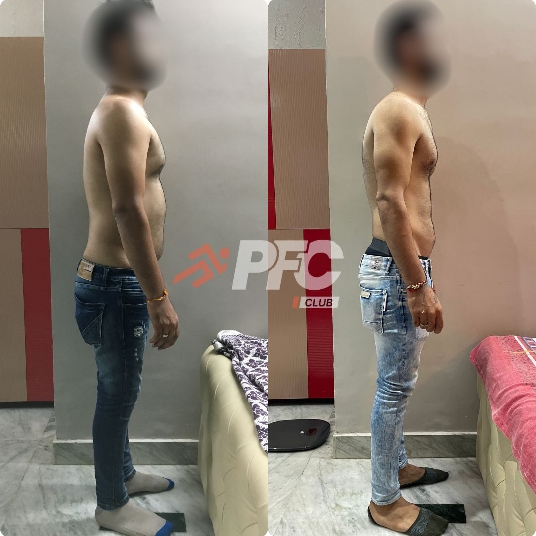 Transformation Image