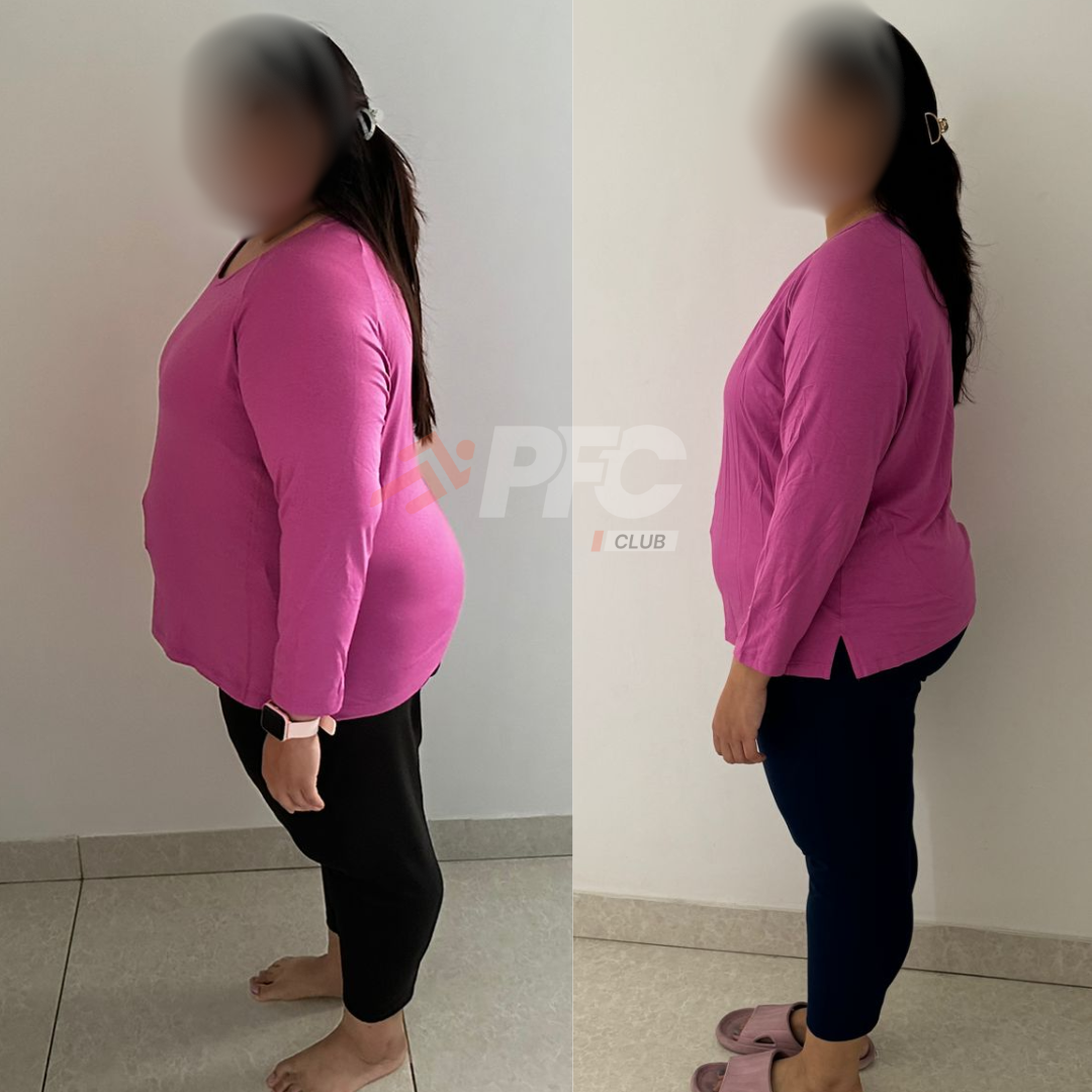 Transformation Image