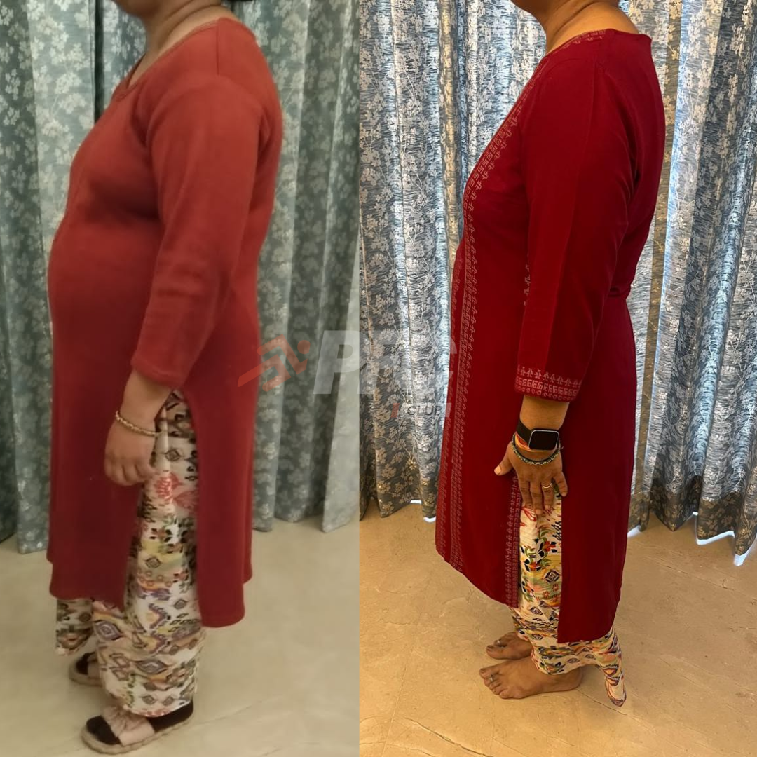 Transformation Image