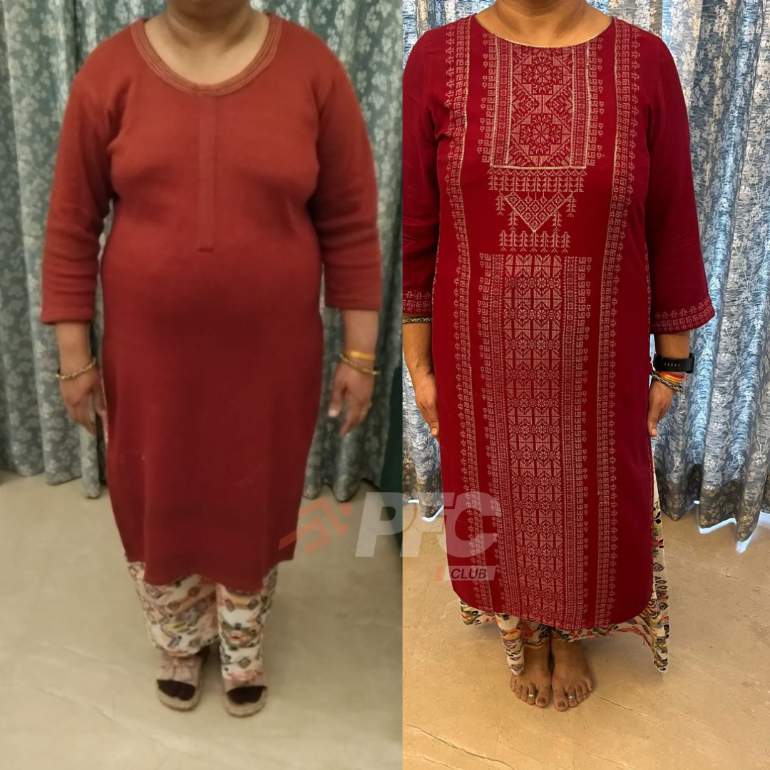 Transformation Image