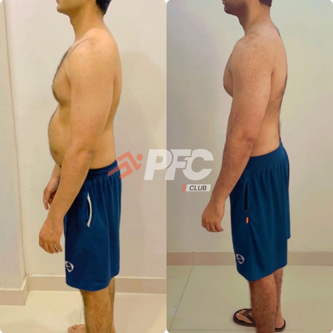 Transformation Image