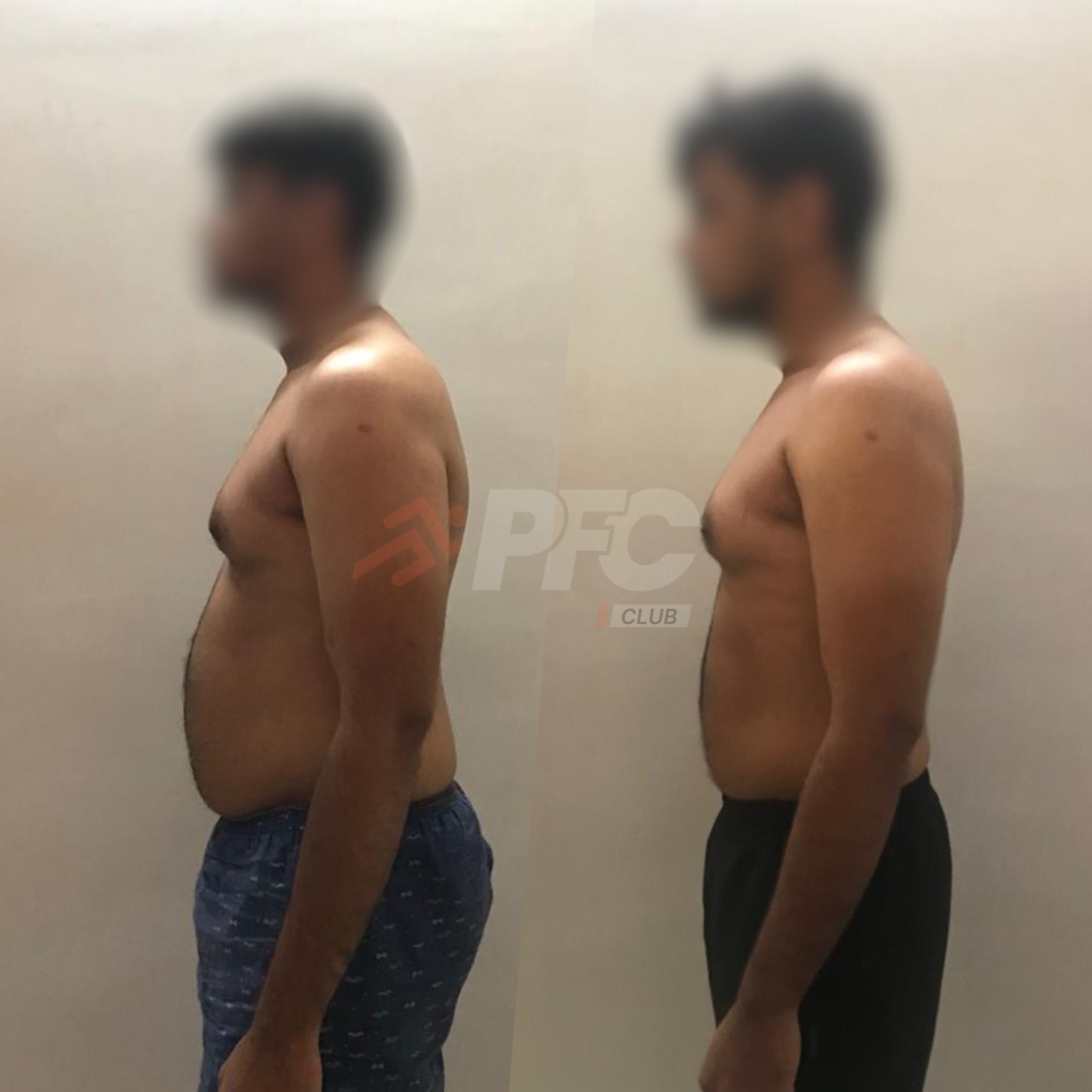 Transformation Image