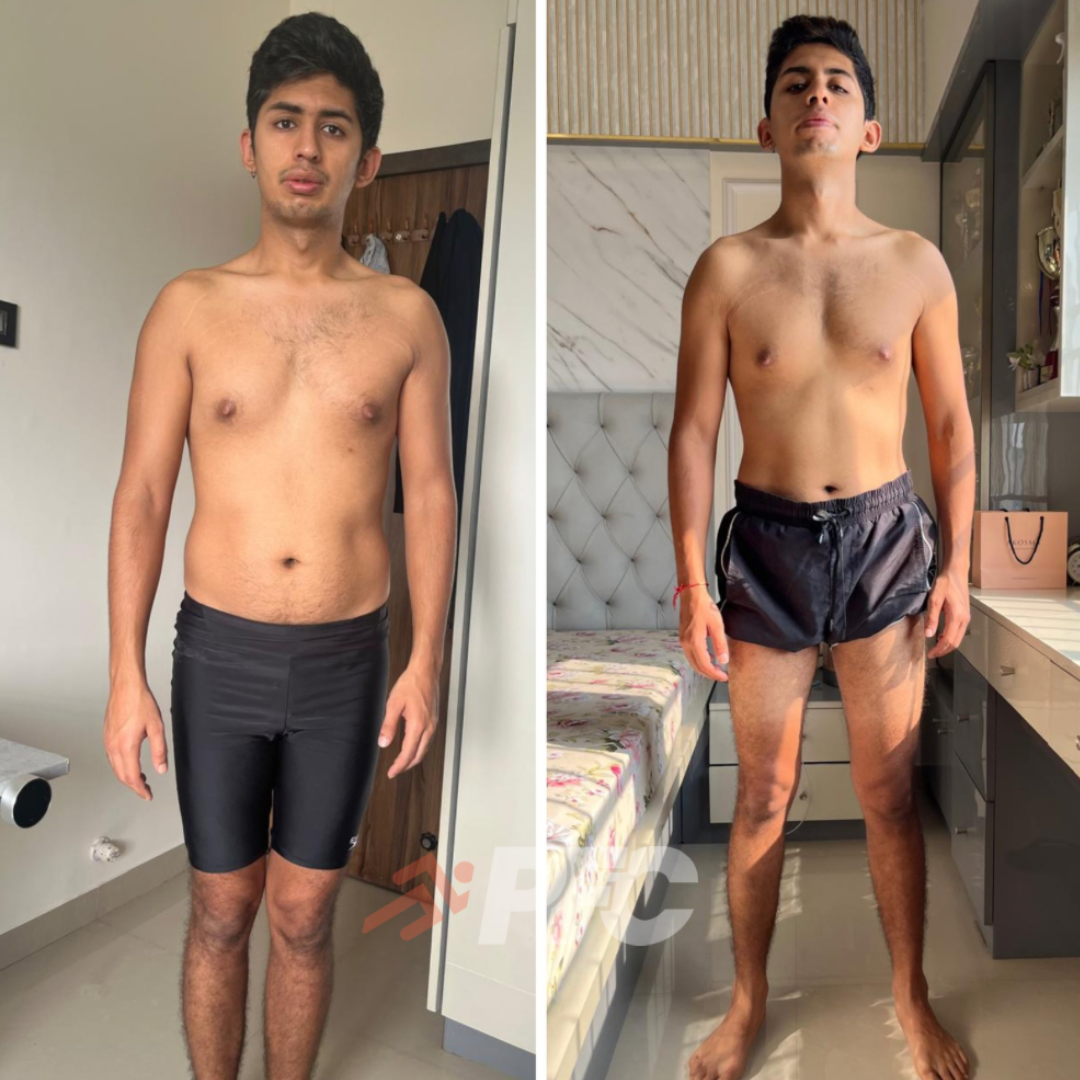 Transformation Image