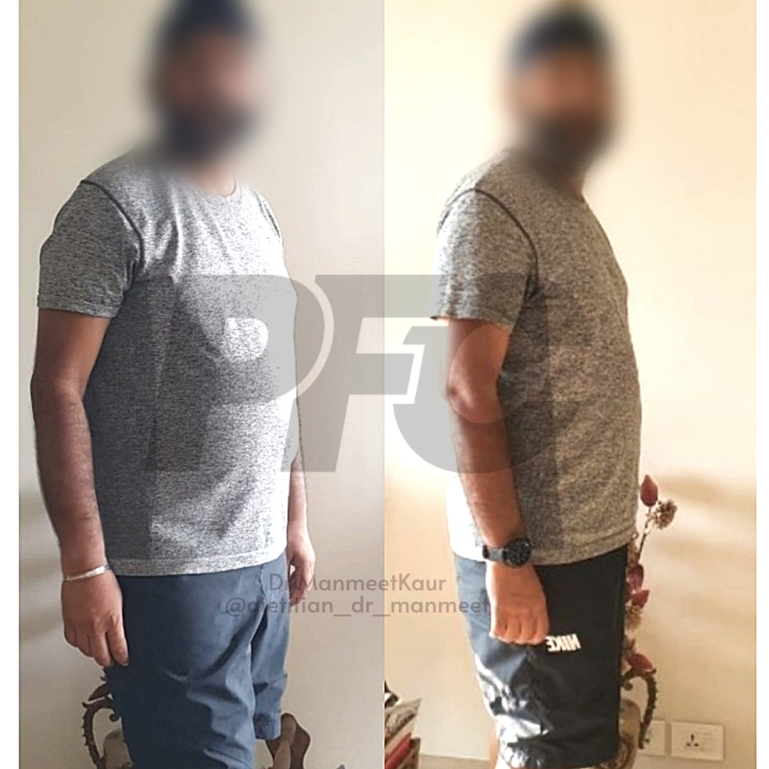 Transformation Image