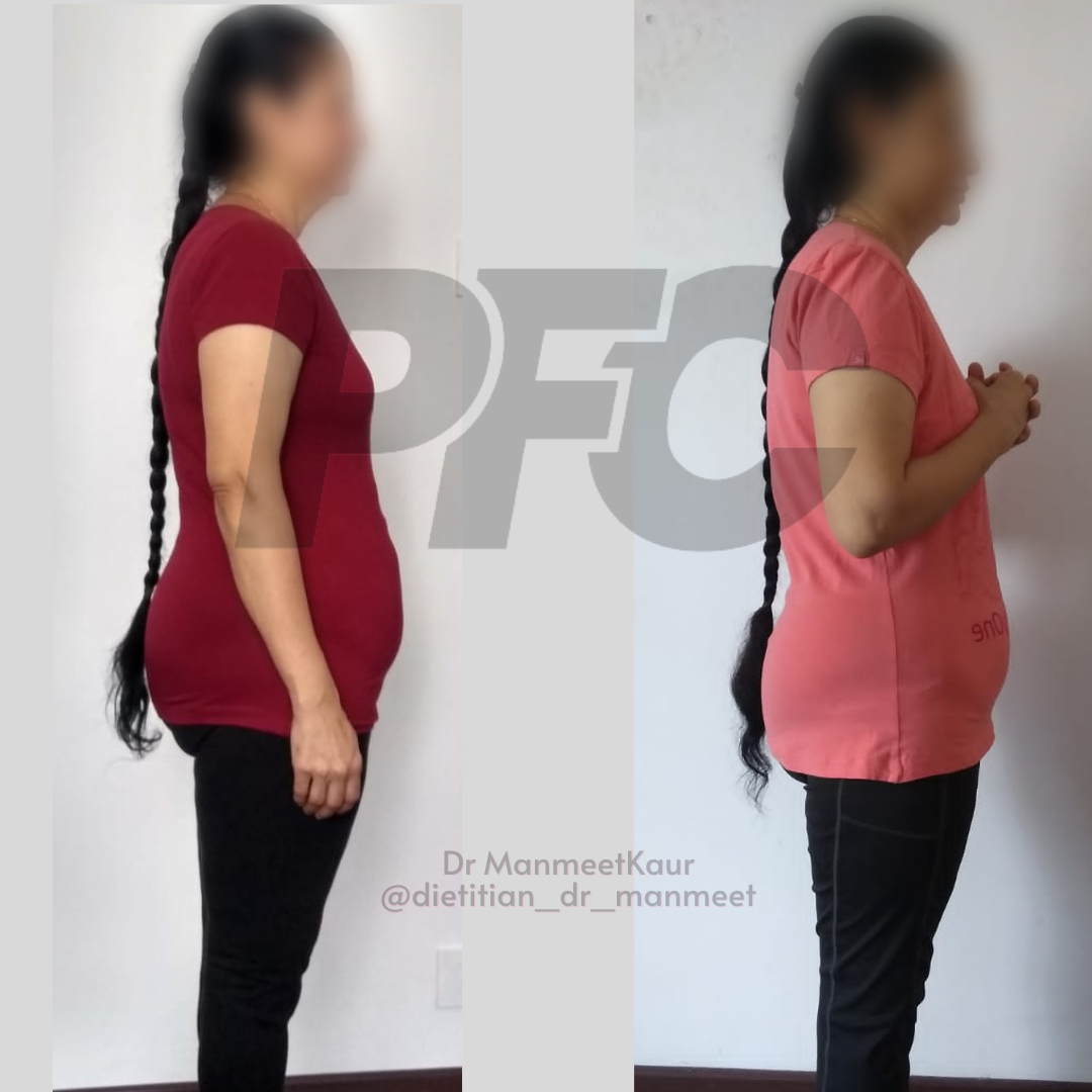 Transformation Image