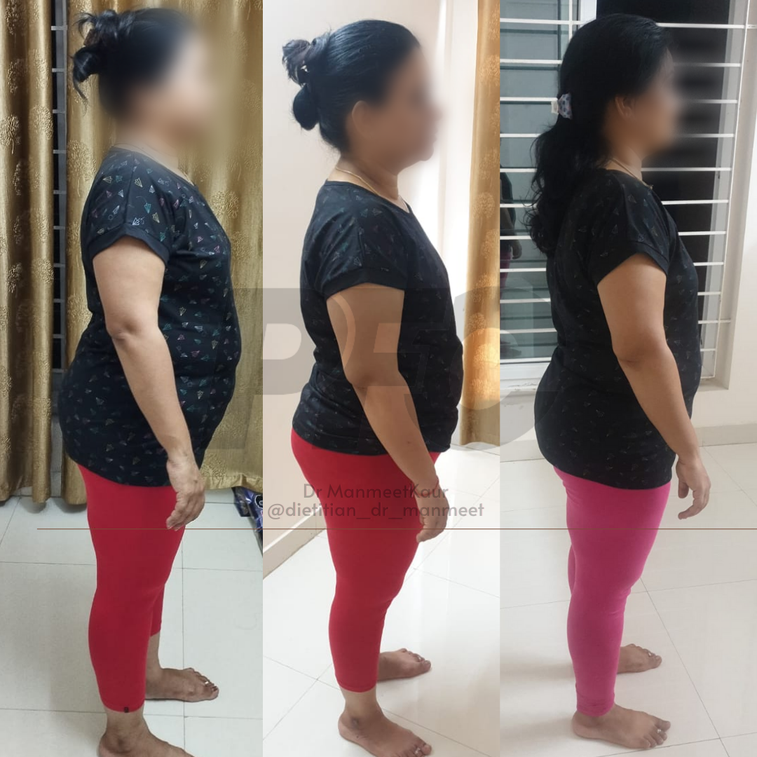 Transformation Image