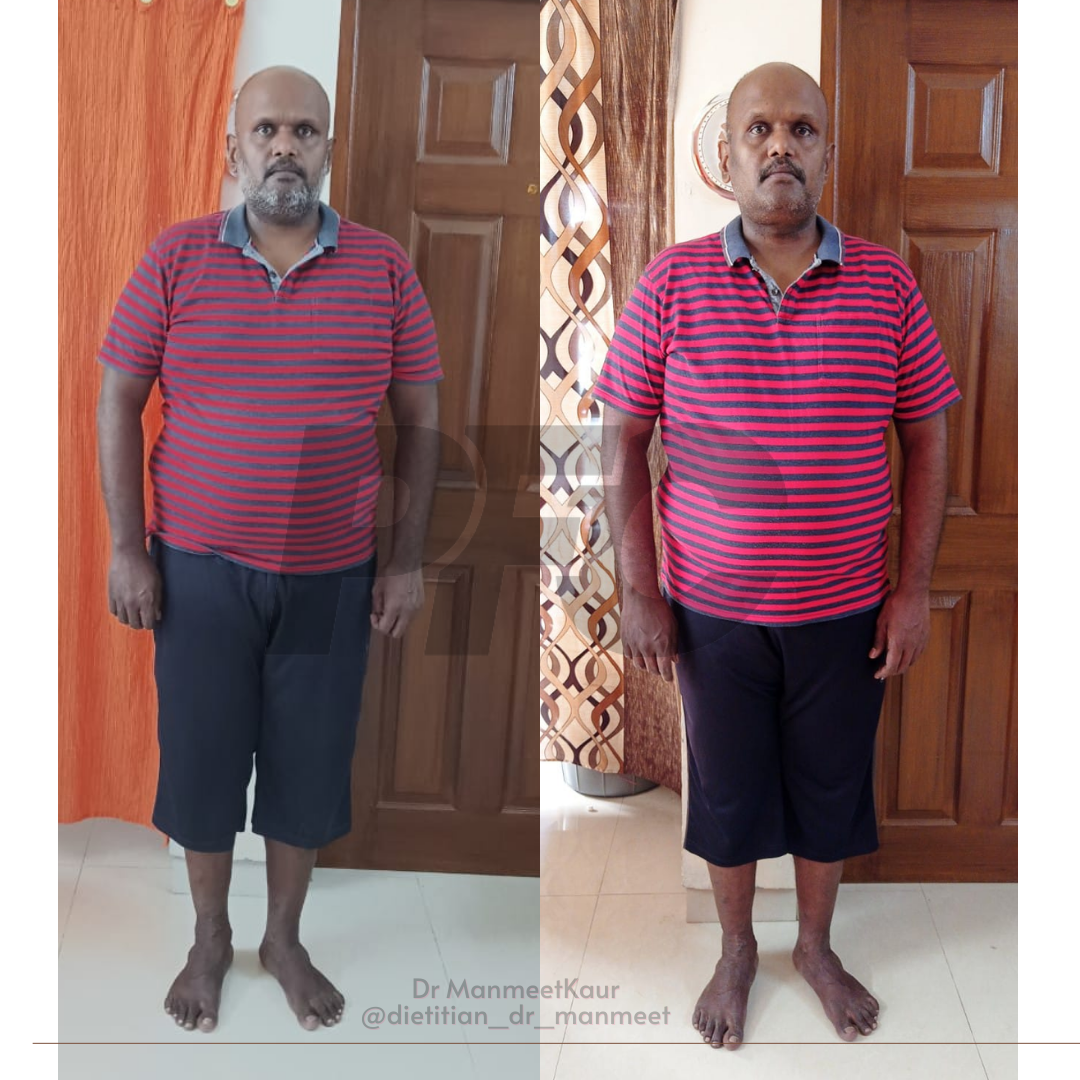 Transformation Image