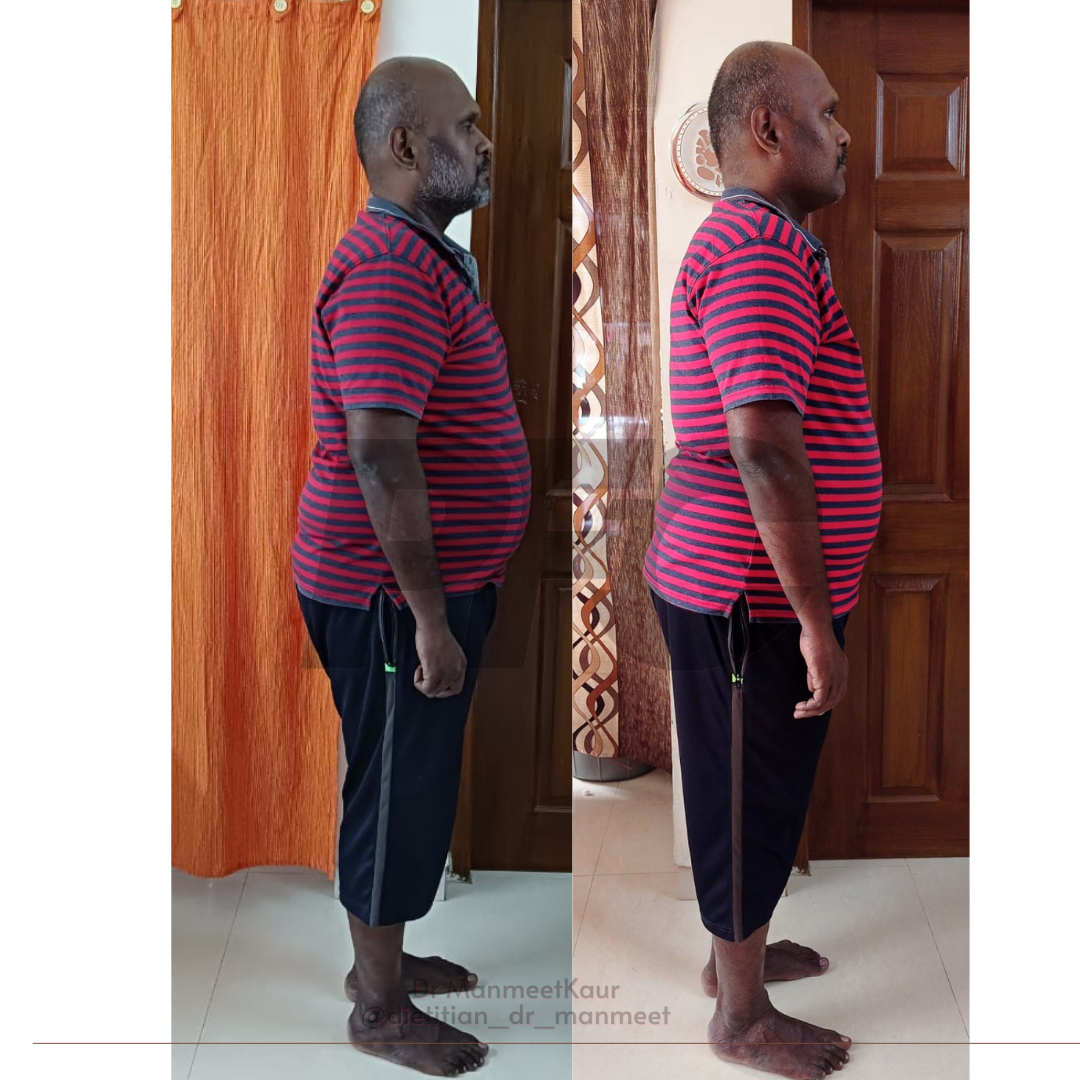 Transformation Image