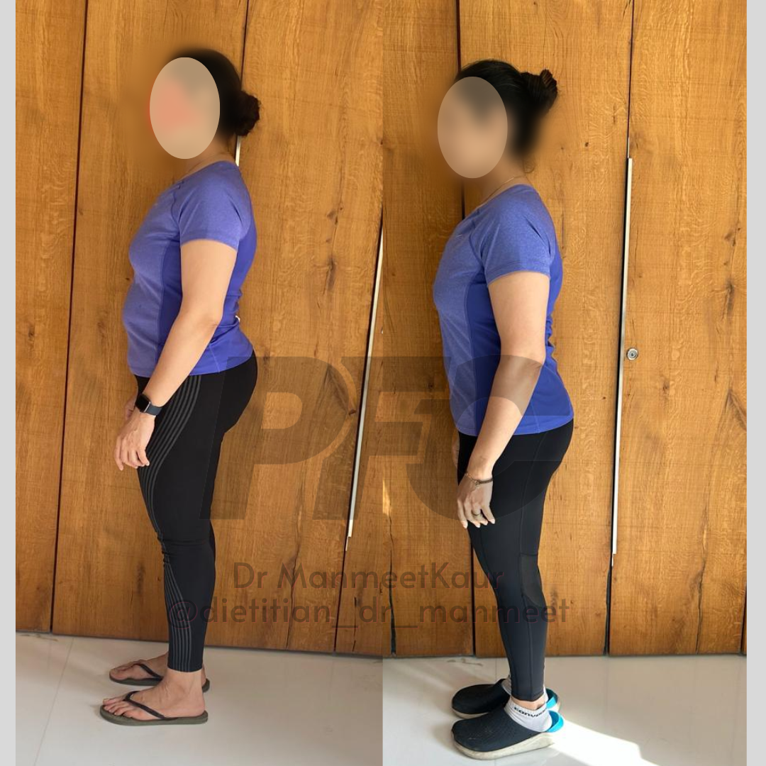 Transformation Image