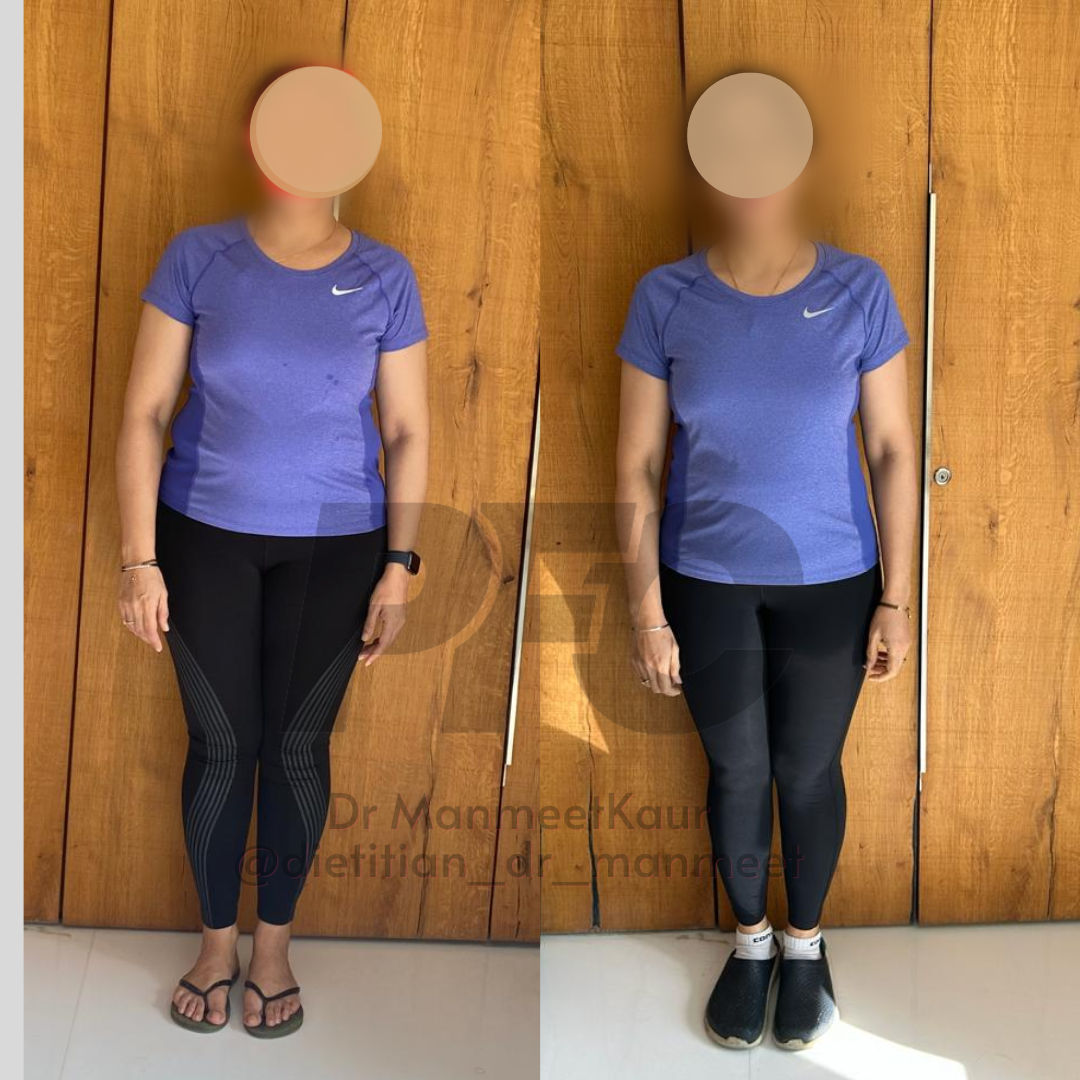 Transformation Image