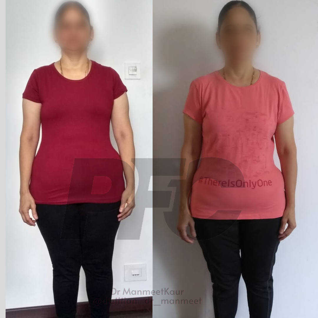 Transformation Image